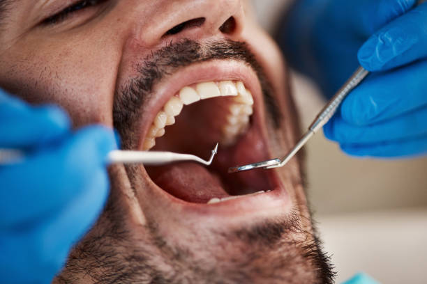 Best Emergency Denture Repair in Norwalk, OH